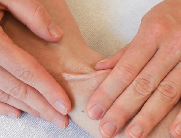 Littekentherapie Littekentherapie