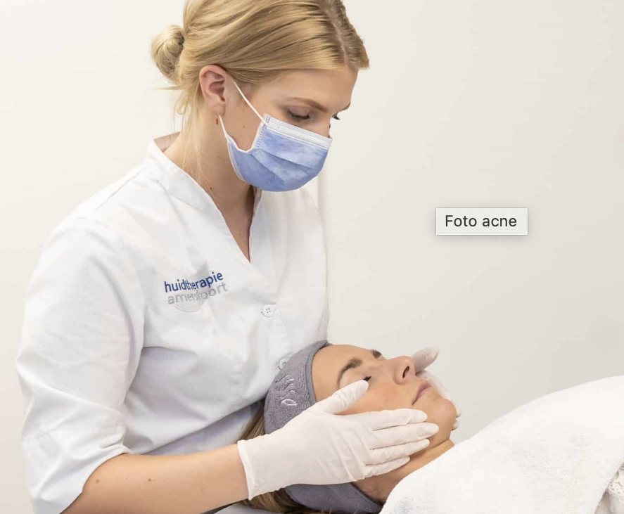 Acne behandeling Acne behandeling